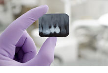 Get to know gum disease